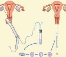 35岁女性备孕请做好以下检查，“健康青岛代生宝宝”跑不远